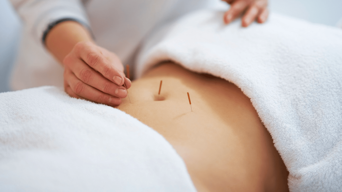 benefits and consideration of acupuncture for fertility